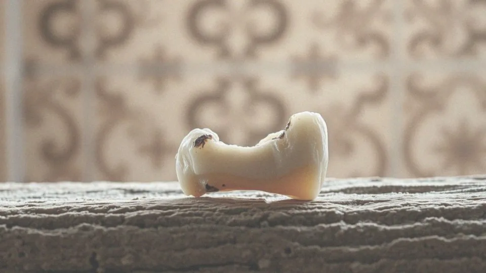 Jak wygląda zepsuty ząb? Objawy i przyczyny problemów z zębami